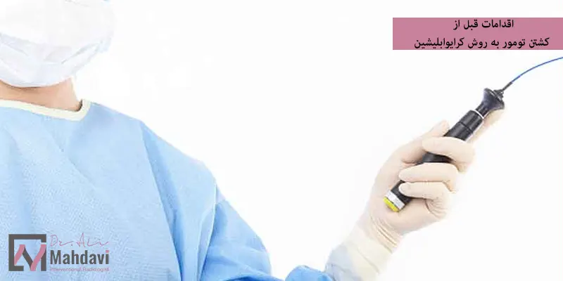 اقدامات قبل از کشتن تومور به روش کرایوابلیشین