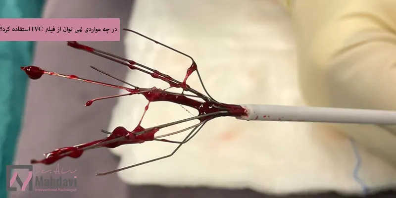 در چه مواردی نمی توان از فیلتر IVC استفاده کرد؟