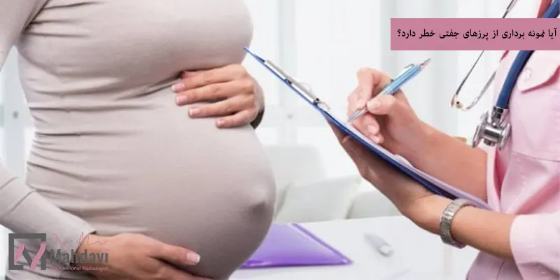 آیا نمونه برداری از پرزهای جفتی خطر دارد؟