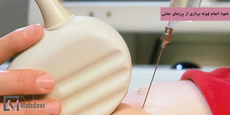 نحوه انجام نمونه برداری از پرزهای جفتی