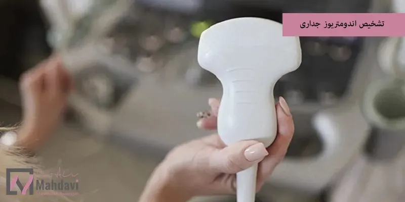 تشخیص اندومتریوز جداری