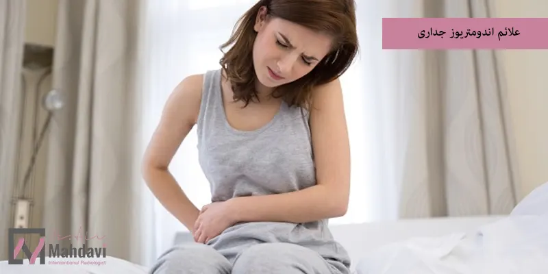 علائم اندومتریوز جداری