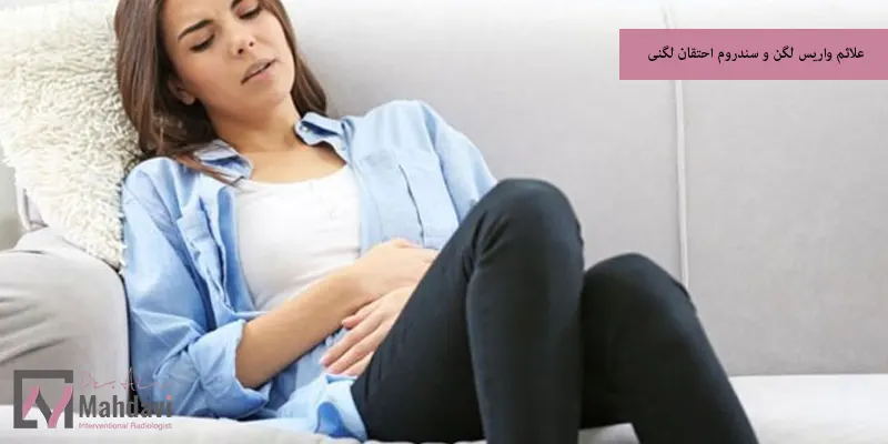 علائم واریس لگن و سندروم احتقان لگنی