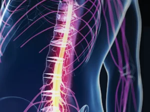 نارسایی وریدی