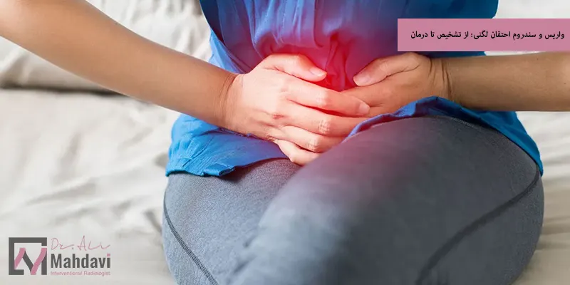 واریس و سندروم احتقان لگنی از تشخیص تا درمان