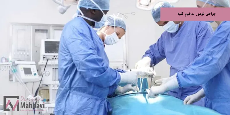 جراحی تومور بدخیم کلیه