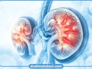 درمان تومور بدخیم کلیه