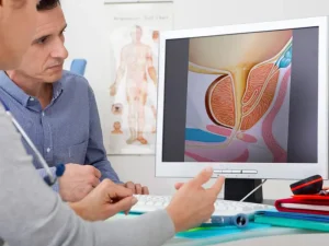 بزرگی خوش خیم پروستات