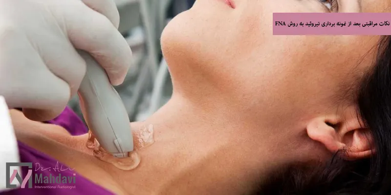 نکات مراقبتی بعد از نمونه برداری تیروئید به روش FNA