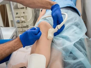 rf واریس اندام تحتانی