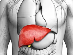 کموآمبولیزاسیون