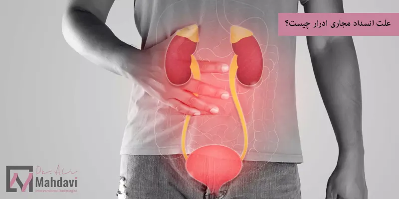 علت انسداد مجاری ادرار چیست؟