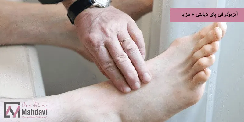 آنژیوگرافی پای دیابتی + مزایا