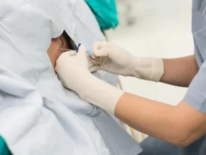 بلوک اپیدورال