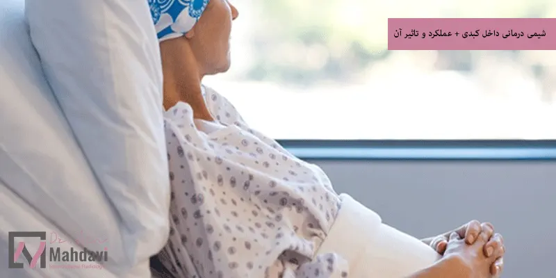 شیمی درمانی داخل کبدی + عملکرد و تاثیر آن