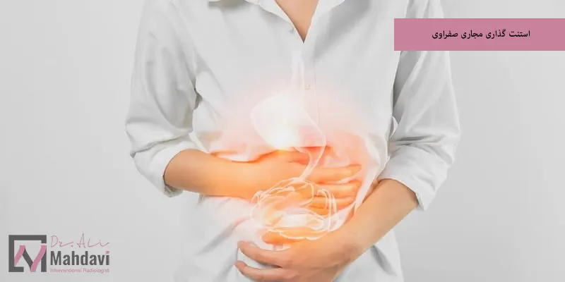 استنت گذاری مجاری صفراوی