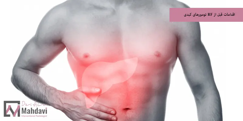 اقدامات قبل از RF تومورهای کبدی