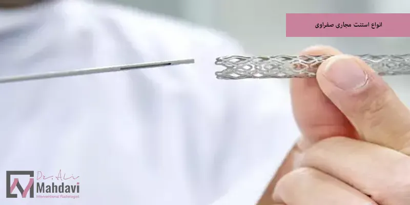 انواع استنت مجاری صفراوی