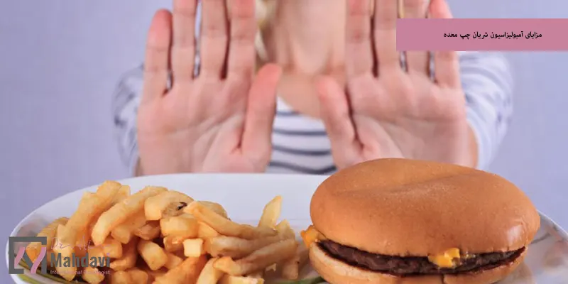 مزایای آمبولیزاسیون شریان چپ معده