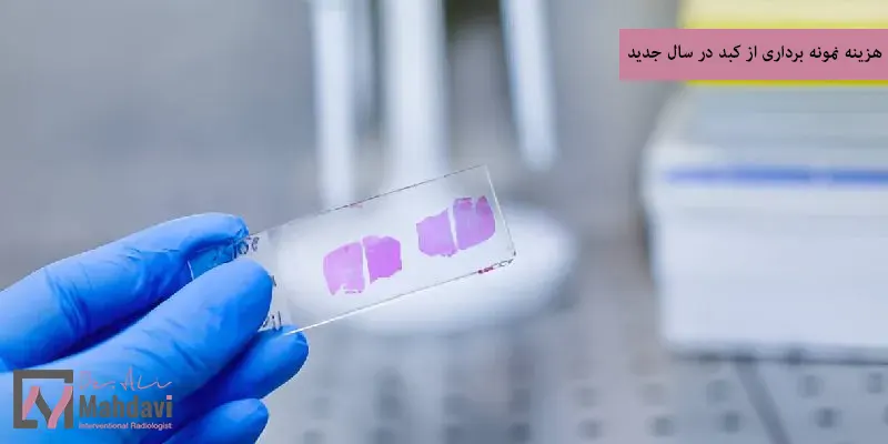 هزینه نمونه برداری از کبد در سال جدید