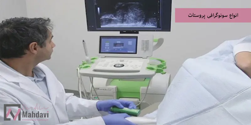 انواع سونوگرافی پروستات
