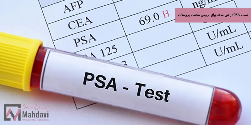تست PSA؛ راهی ساده برای بررسی سلامت پروستات