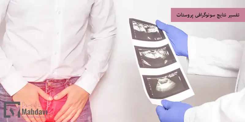 تفسیر نتایج سونوگرافی پروستات