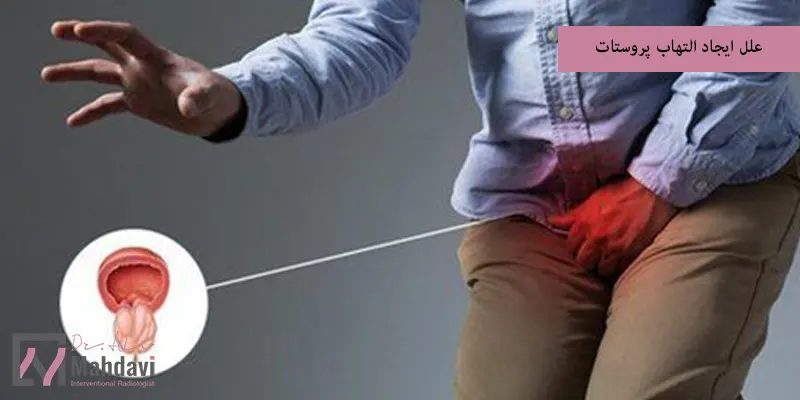 علل ایجاد التهاب پروستات