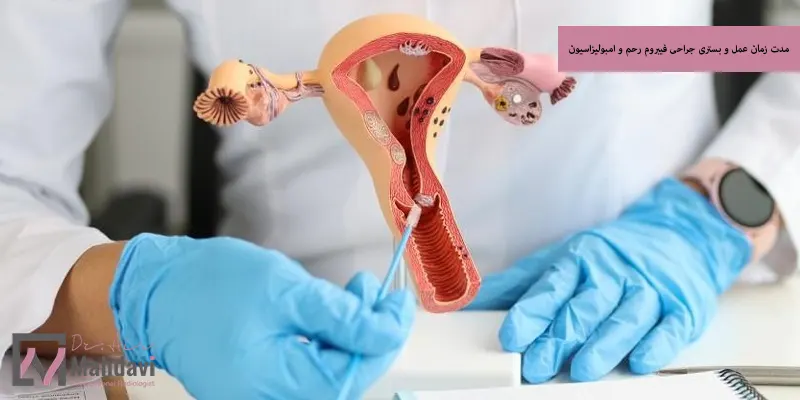 مدت زمان عمل و بستری جراحی فیبروم رحم و امبولیزاسیون