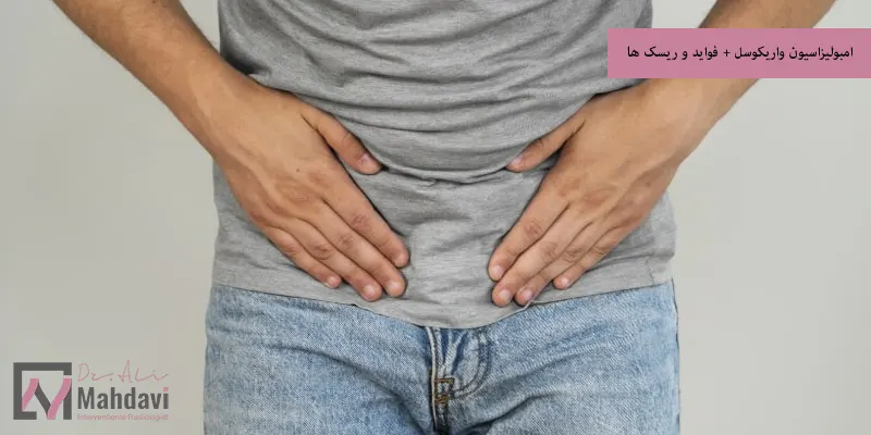 امبولیزاسیون واریکوسل + فواید و ریسک ها