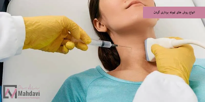 انواع روش های نمونه برداری گردن