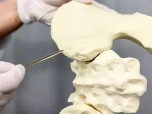 بیوپسی استخواان چیست