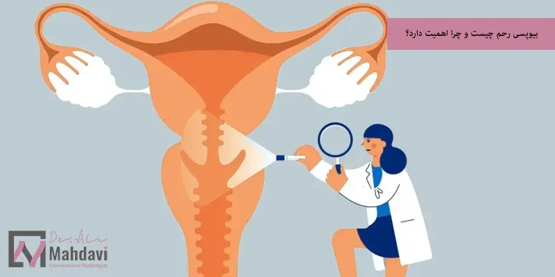 بیوپسی رحم چیست و چرا اهمیت دارد؟