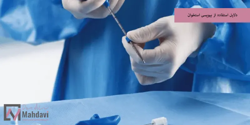 دلایل استفاده از بیوپسی استخوان