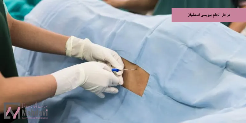 مراحل انجام بیوپسی استخوان