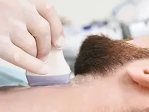 نمونه برداری از گردن