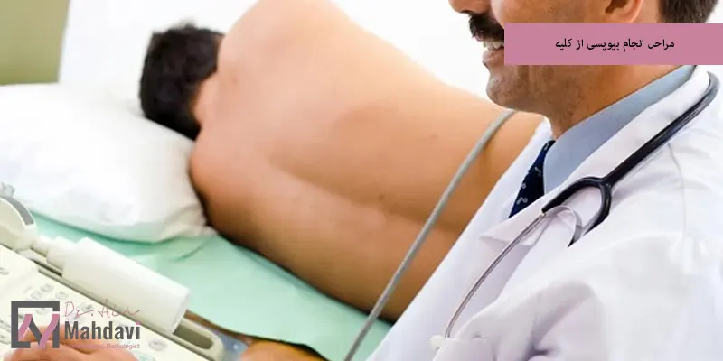 مراحل انجام بیوپسی از کلیه