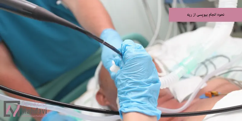 نحوه انجام بیوپسی از ریه