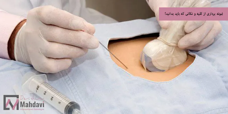 نمونه برداری از کلیه و نکاتی که باید بدانید!