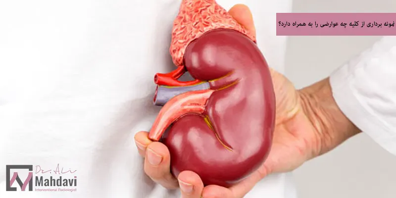 نمونه برداری از کلیه چه عوارضی را به همراه دارد؟