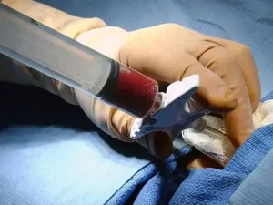 هزینه بیوپسی از مغز استخوان