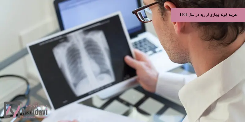 هزینه نمونه برداری از ریه در سال 1404