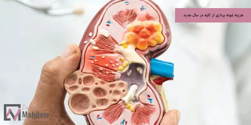 هزینه نمونه برداری از کلیه در سال 1404