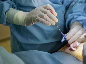 هزینه بیوپسی کبد