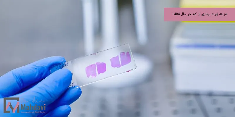 هزینه نمونه برداری از کبد در سال 1404