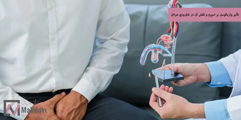 تأثیر واریکوسل بر اسپرم و نقش آن در ناباروری مردان