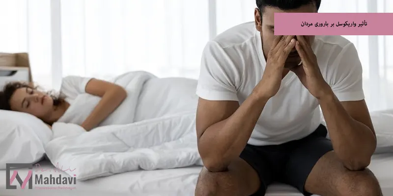 تأثیر واریکوسل بر باروری مردان