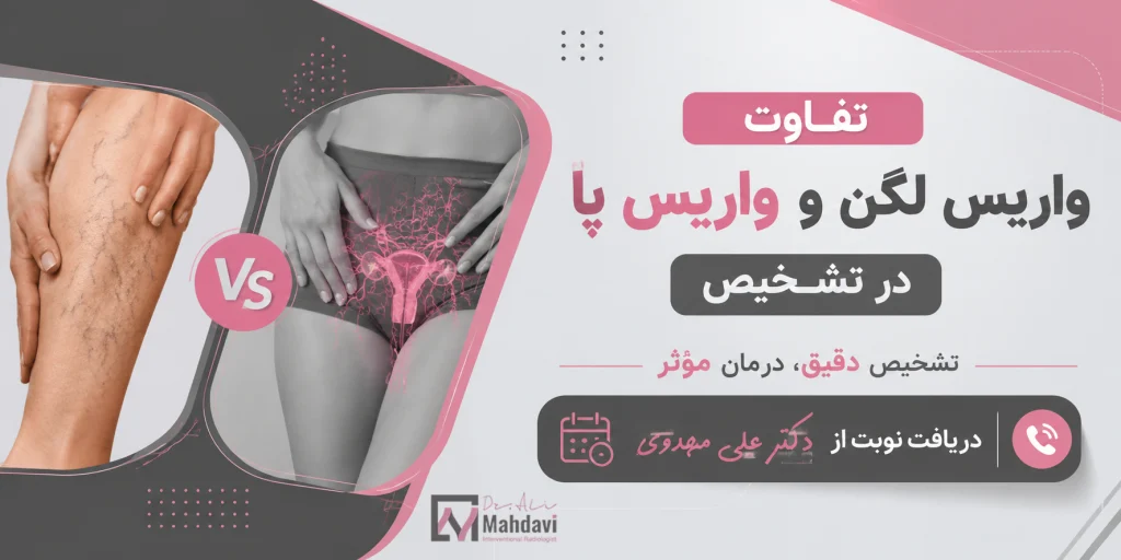 دریافت نوبت از دکتر علی مهدوی برای تشخیص واریس بگن و واریس پا
