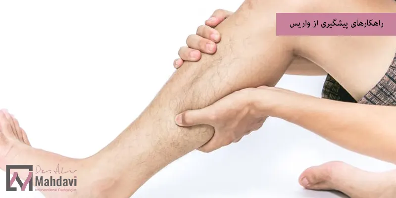 راهکارهای پیشگیری از واریس